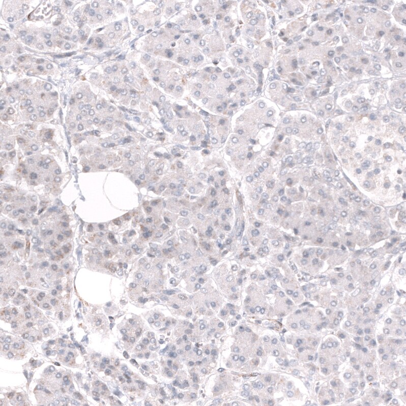 BCOR Antibody (CL13841) - Azide and BSA Free Immunohistochemistry-Paraffin: BCOR Antibody [NBP3-43828]
