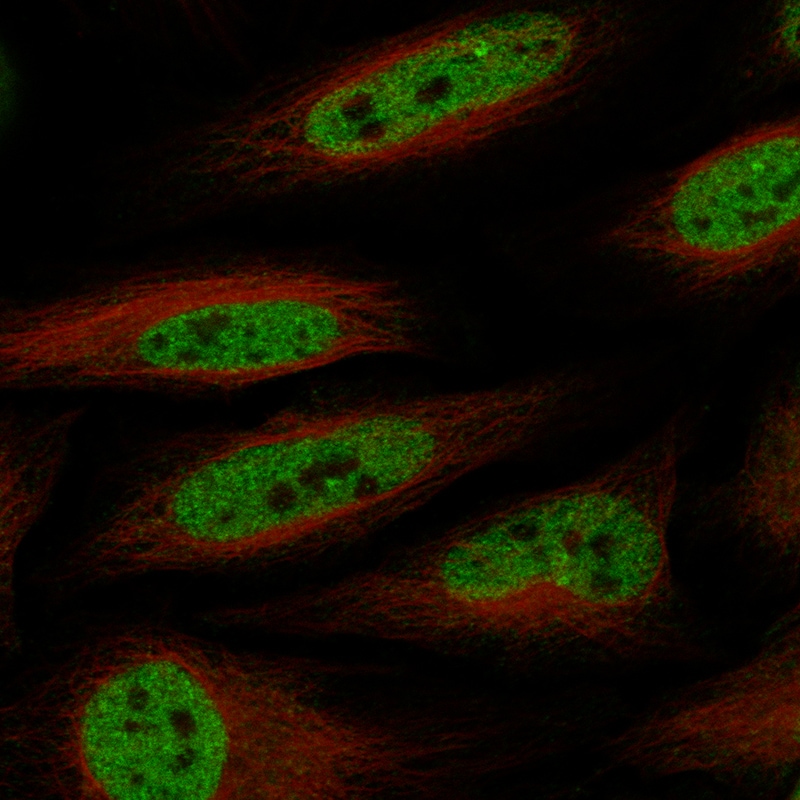 Brg1 Antibody (CL13779) - Azide and BSA Free Immunocytochemistry/ Immunofluorescence: Brg1 Antibody [NBP3-43829]