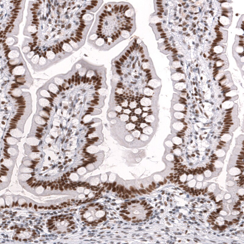 Brg1 Antibody (CL13783) - Azide and BSA Free Immunohistochemistry-Paraffin: Brg1 Antibody [NBP3-43830]