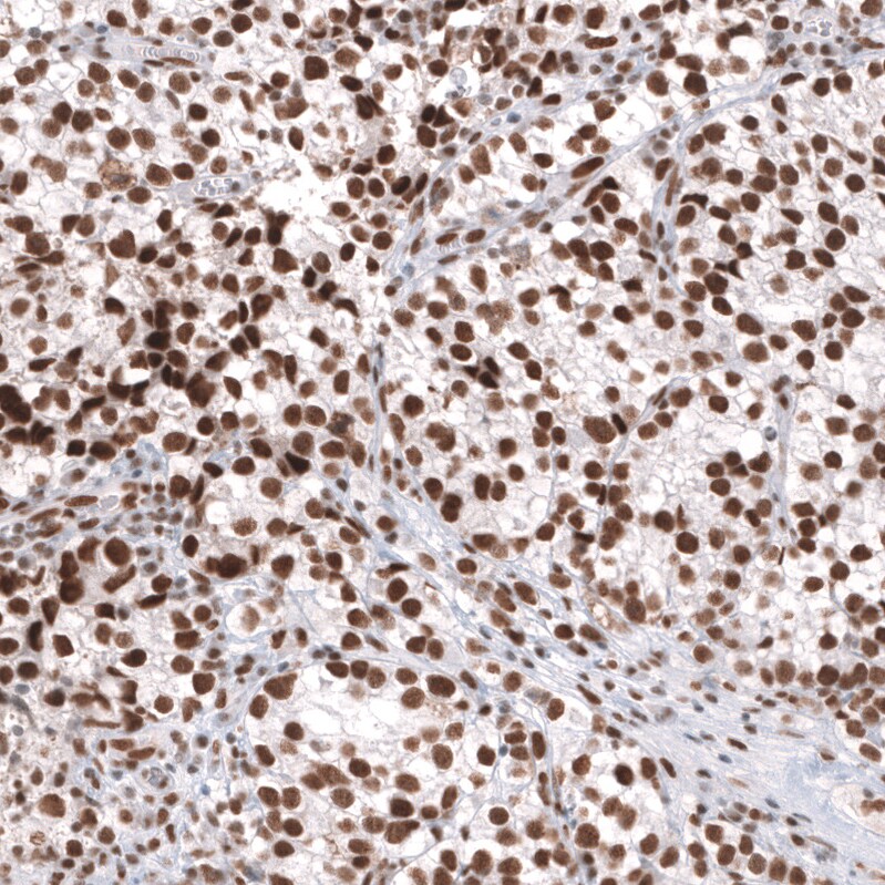 Brg1 Antibody (CL13783) - Azide and BSA Free Immunohistochemistry-Paraffin: Brg1 Antibody [NBP3-43830]