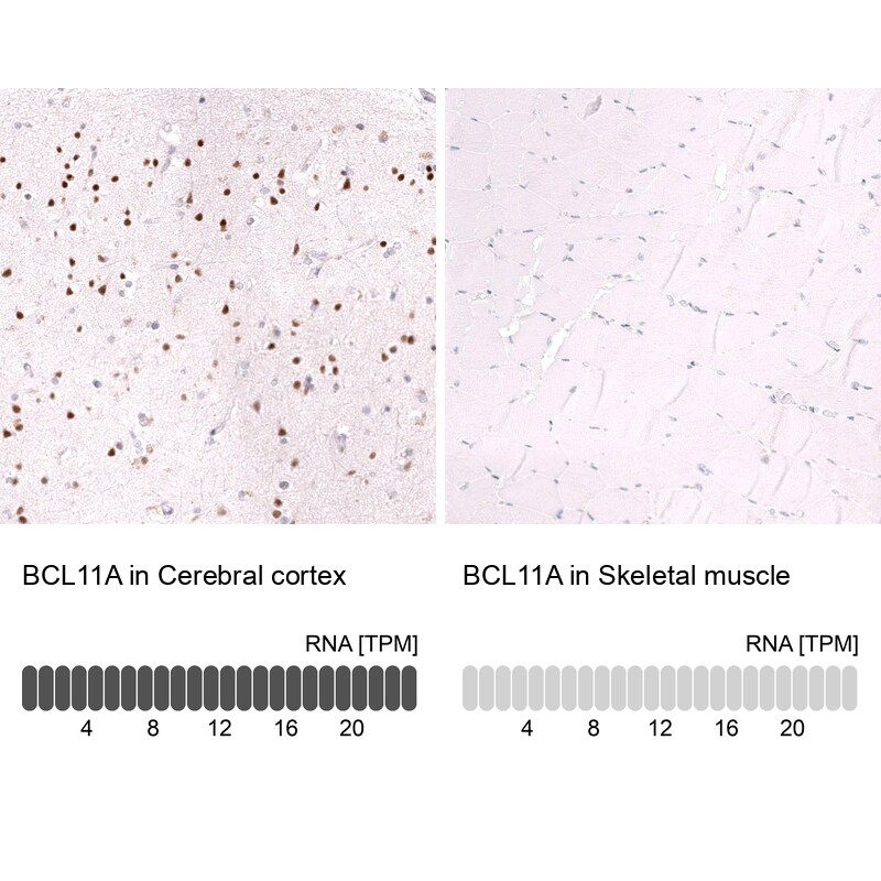 Ctip1 Antibody (CL13501) - Azide and BSA Free Immunohistochemistry-Paraffin: Ctip1 Antibody [NBP3-43831]