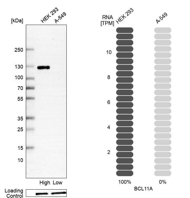 Ctip1 Antibody (CL13501) - Azide and BSA Free Western Blot: Ctip1 Antibody [NBP3-43831]