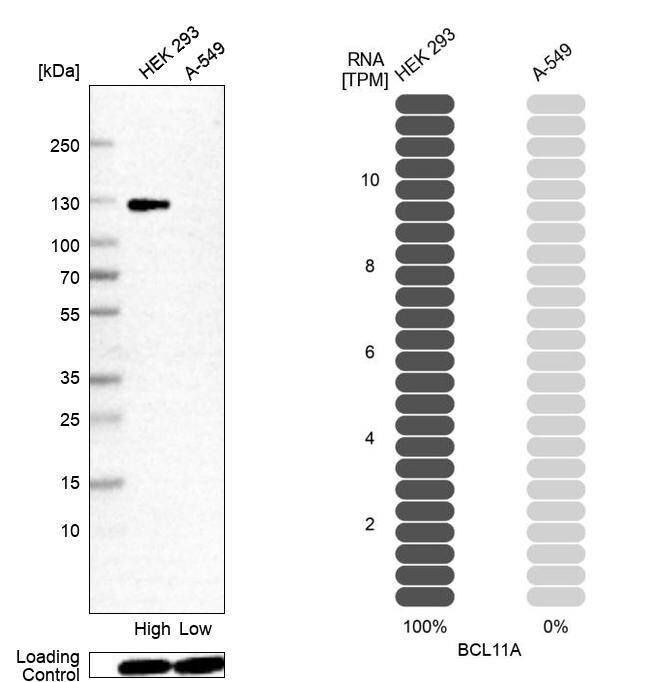 Ctip1 Antibody (CL13530) - Azide and BSA Free Western Blot: Ctip1 Antibody [NBP3-43832]
