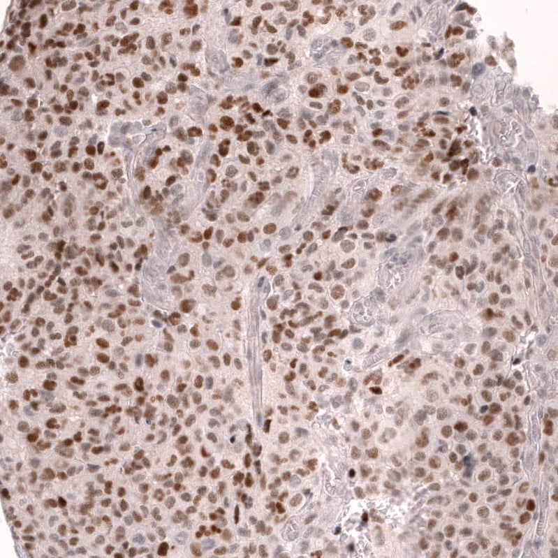 FOXO3 Antibody (CL13589) - Azide and BSA Free Immunohistochemistry-Paraffin: FOXO3 Antibody [NBP3-43833]