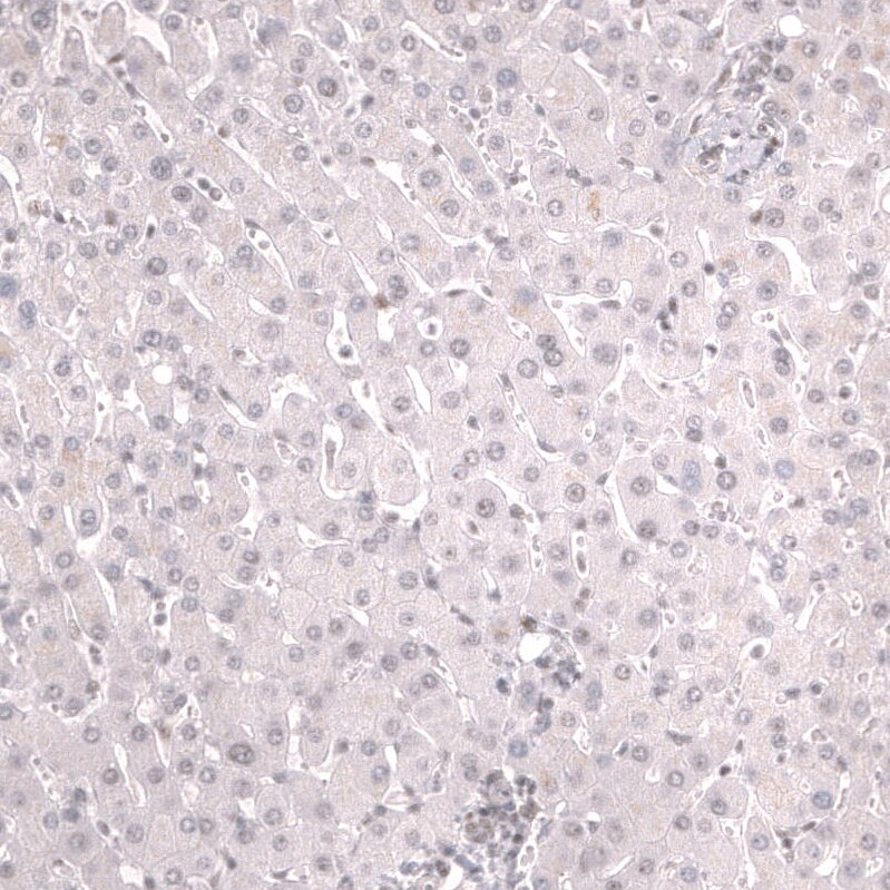FOXO3 Antibody (CL13589) - Azide and BSA Free Immunohistochemistry-Paraffin: FOXO3 Antibody [NBP3-43833]