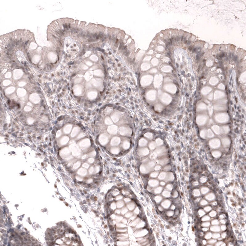 FOXO3 Antibody (CL13589) - Azide and BSA Free Immunohistochemistry-Paraffin: FOXO3 Antibody [NBP3-43833]