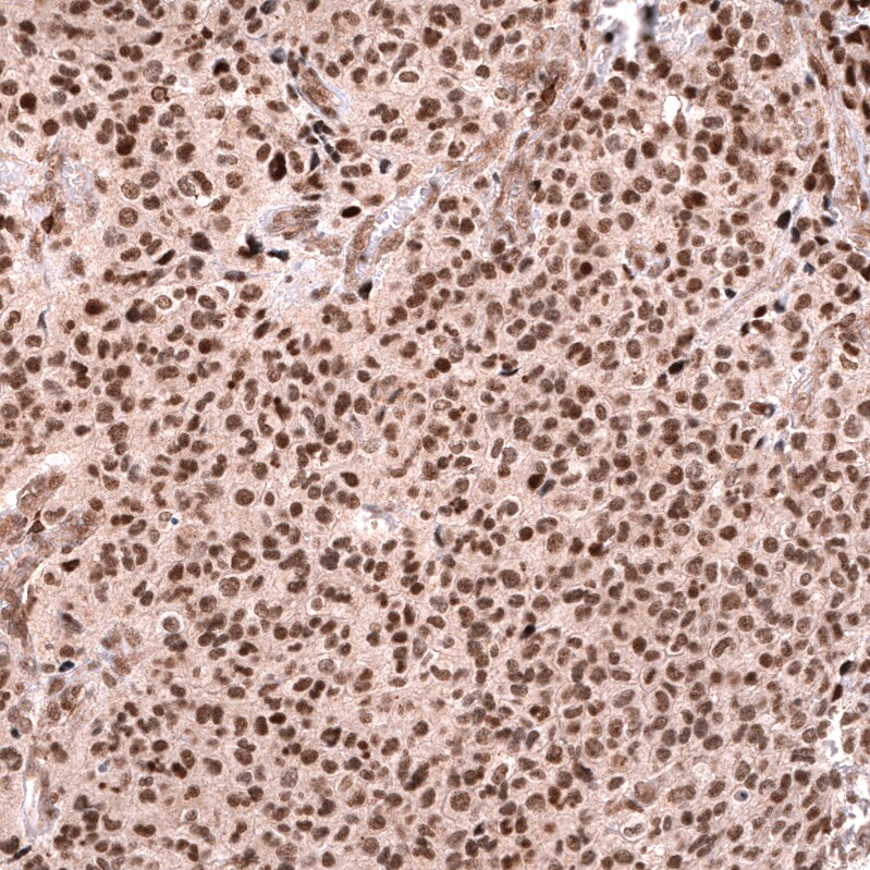 FOXO3 Antibody (CL13603) - Azide and BSA Free Immunohistochemistry-Paraffin: FOXO3 Antibody [NBP3-43834]