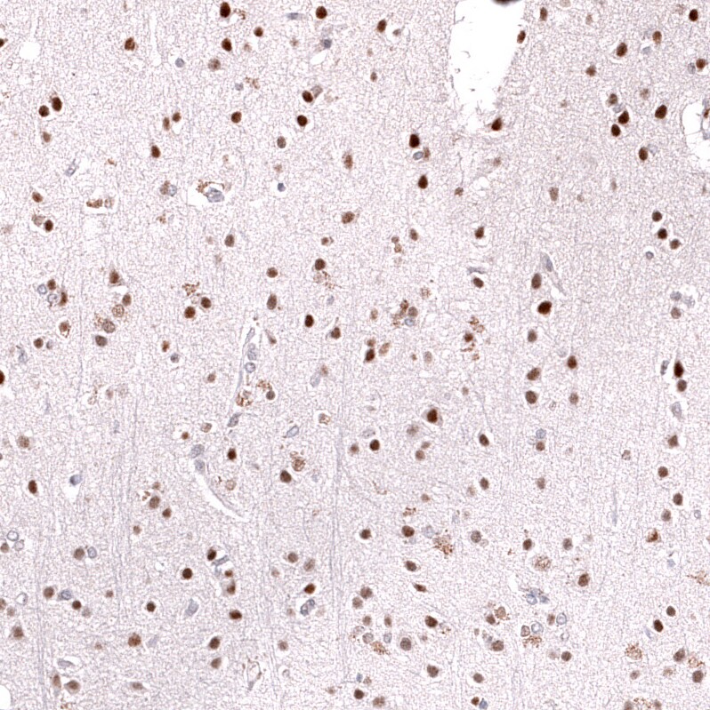 FOXO3 Antibody (CL13603) - Azide and BSA Free Immunohistochemistry-Paraffin: FOXO3 Antibody [NBP3-43834]