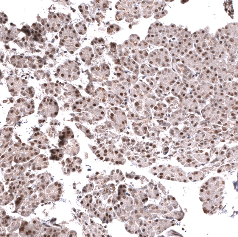 FOXO3 Antibody (CL13603) - Azide and BSA Free Immunohistochemistry-Paraffin: FOXO3 Antibody [NBP3-43834]
