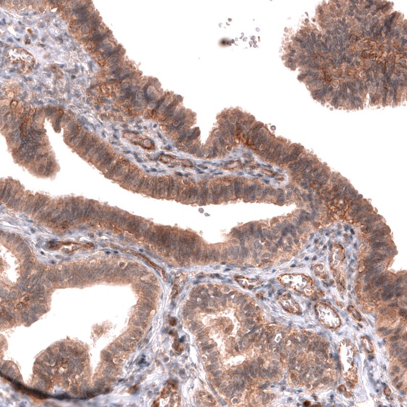 FXYD5/Dysadherin Antibody (CL14037) - Azide and BSA Free Immunohistochemistry-Paraffin: FXYD5/Dysadherin Antibody [NBP3-43835]