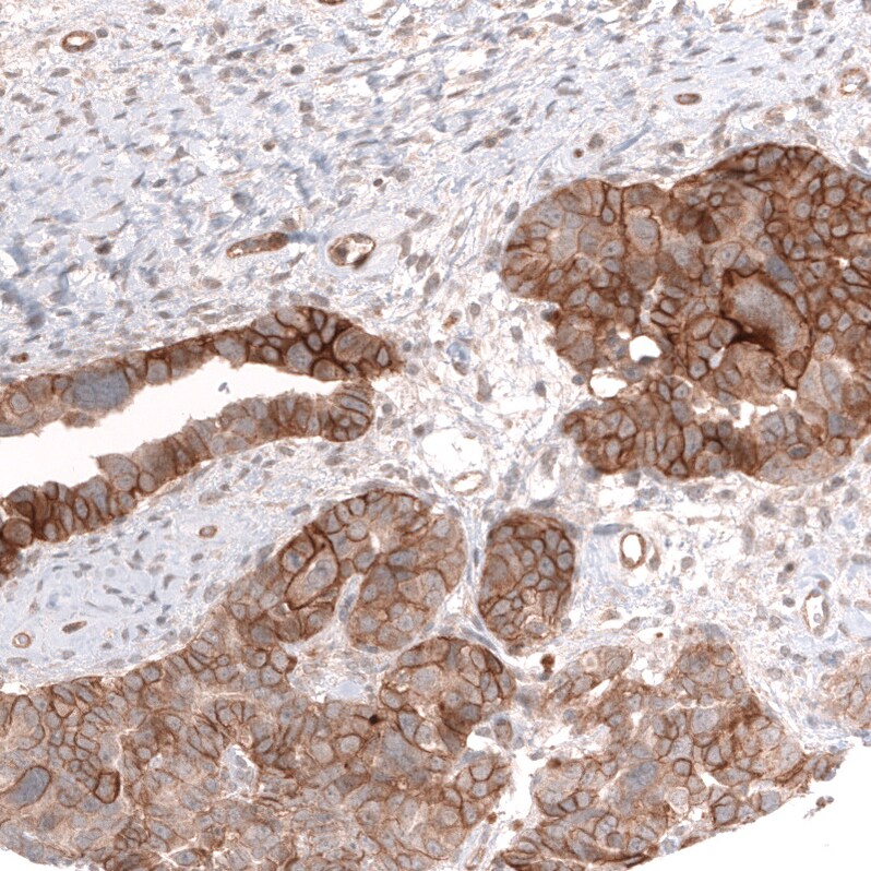 FXYD5/Dysadherin Antibody (CL14037) - Azide and BSA Free Immunohistochemistry-Paraffin: FXYD5/Dysadherin Antibody [NBP3-43835]