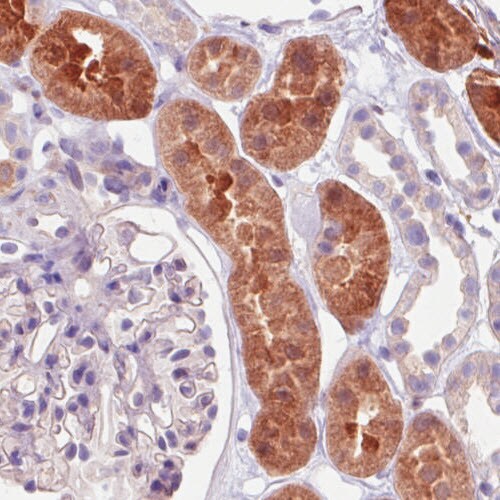 Isocitrate Dehydrogenase 1/IDH1 Antibody (CL0219) - Azide and BSA Free Immunohistochemistry-Paraffin: Isocitrate Dehydrogenase 1/IDH1 Antibody [NBP3-43836]