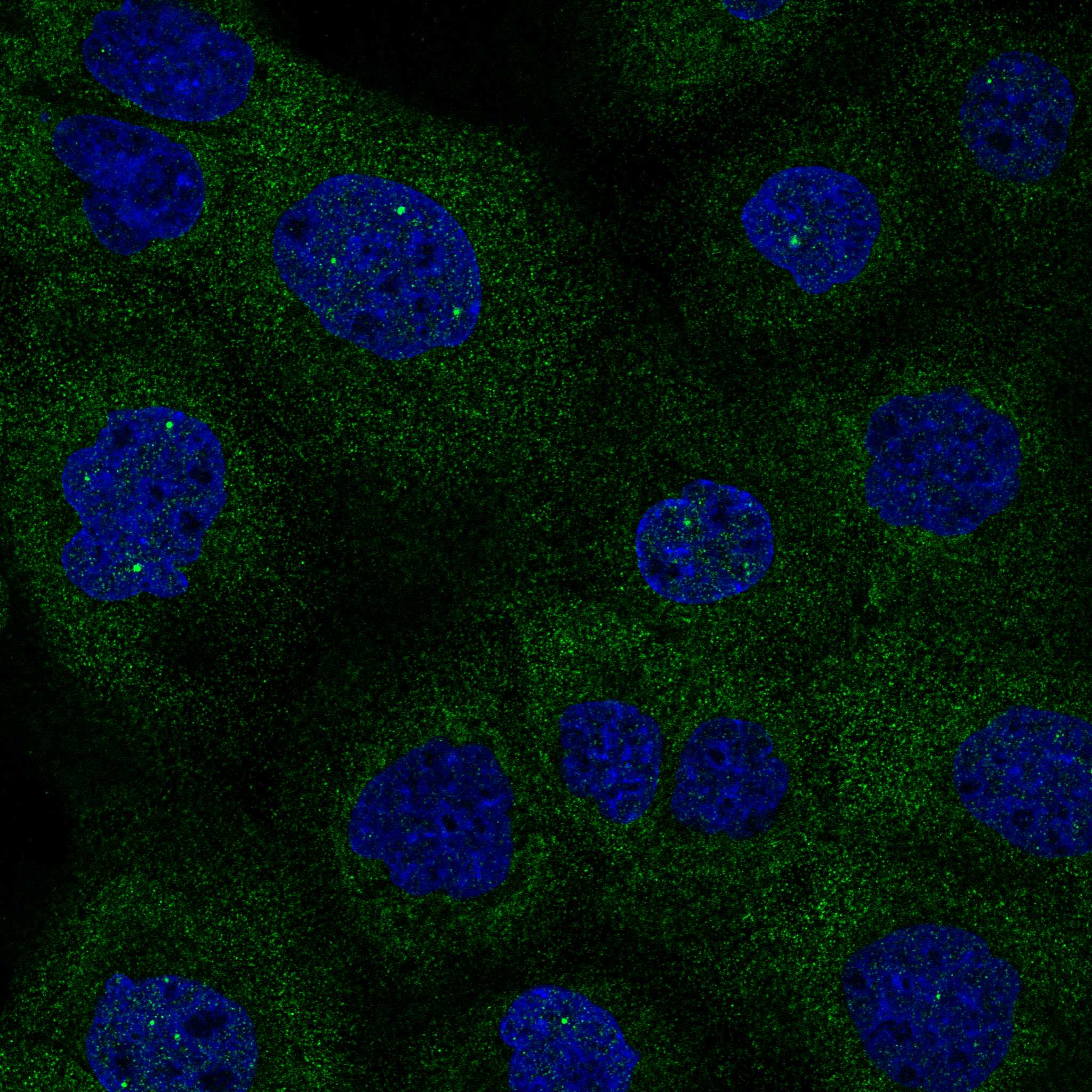 Isocitrate Dehydrogenase 1/IDH1 Antibody (CL0219) - Azide and BSA Free Immunocytochemistry/ Immunofluorescence: Isocitrate Dehydrogenase 1/IDH1 Antibody [NBP3-43836]
