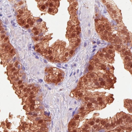 Isocitrate Dehydrogenase 1/IDH1 Antibody (CL0219) - Azide and BSA Free Immunohistochemistry-Paraffin: Isocitrate Dehydrogenase 1/IDH1 Antibody [NBP3-43836]