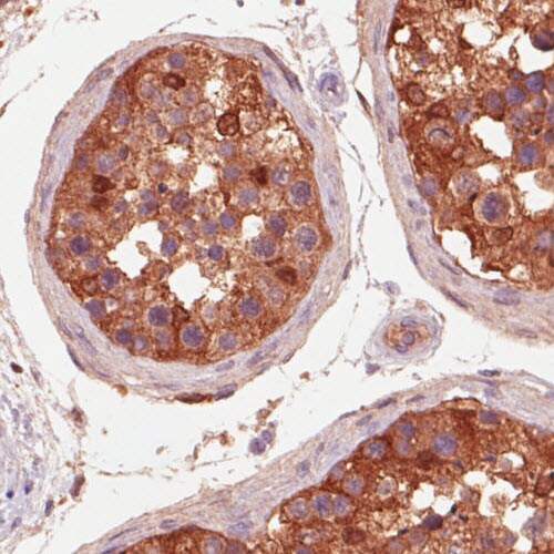 Isocitrate Dehydrogenase 1/IDH1 Antibody (CL0219) - Azide and BSA Free Immunohistochemistry-Paraffin: Isocitrate Dehydrogenase 1/IDH1 Antibody [NBP3-43836]