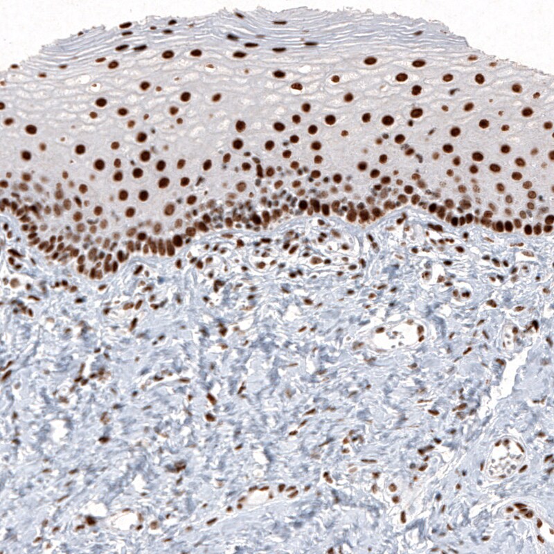 Histone H2AY/macroH2A.1 Antibody (CL5256) - Azide and BSA Free Immunohistochemistry-Paraffin: Histone H2AY/macroH2A.1 Antibody [NBP3-43837]