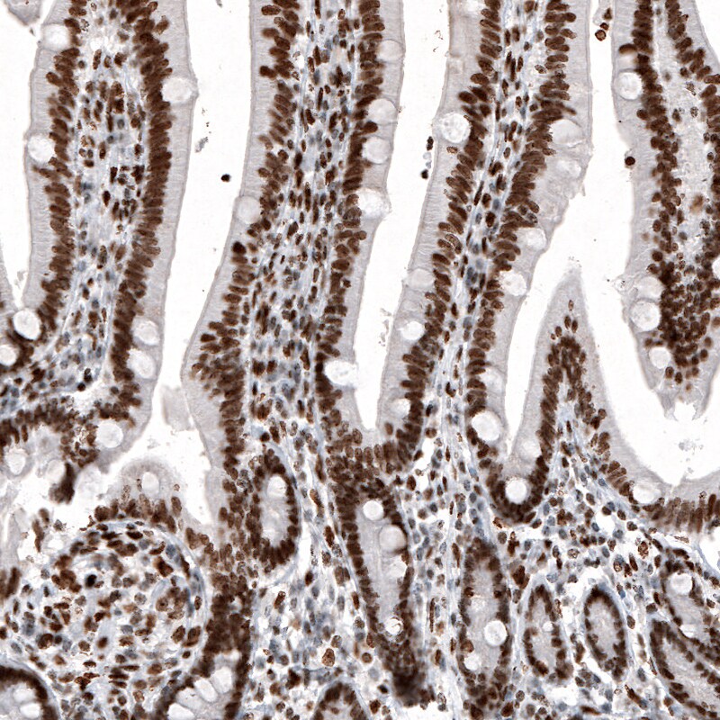 Histone H2AY/macroH2A.1 Antibody (CL5256) - Azide and BSA Free Immunohistochemistry-Paraffin: Histone H2AY/macroH2A.1 Antibody [NBP3-43837]