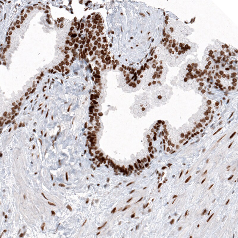 Histone H2AY/macroH2A.1 Antibody (CL5256) - Azide and BSA Free Immunohistochemistry-Paraffin: Histone H2AY/macroH2A.1 Antibody [NBP3-43837]