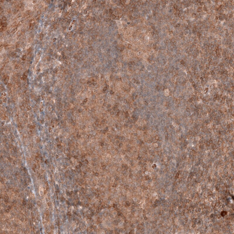 FXYD5/Dysadherin Antibody (CL14039) - Azide and BSA Free Immunohistochemistry-Paraffin: FXYD5/Dysadherin Antibody [NBP3-43838]