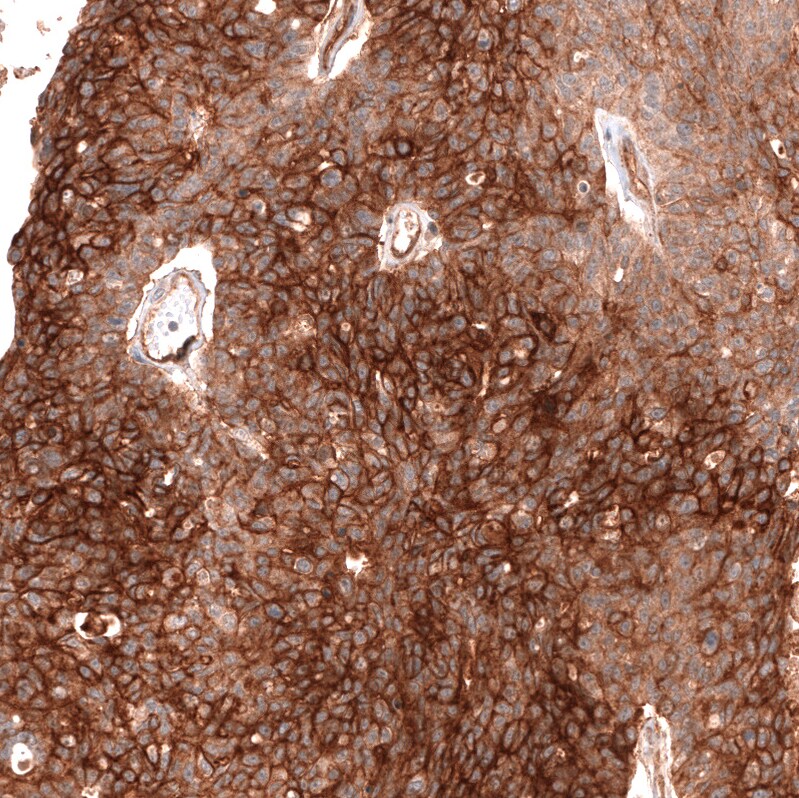 FXYD5/Dysadherin Antibody (CL14039) - Azide and BSA Free Immunohistochemistry-Paraffin: FXYD5/Dysadherin Antibody [NBP3-43838]