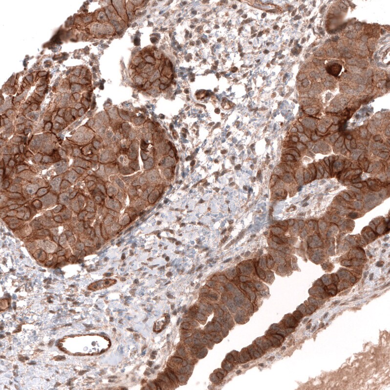 FXYD5/Dysadherin Antibody (CL14039) - Azide and BSA Free Immunohistochemistry-Paraffin: FXYD5/Dysadherin Antibody [NBP3-43838]
