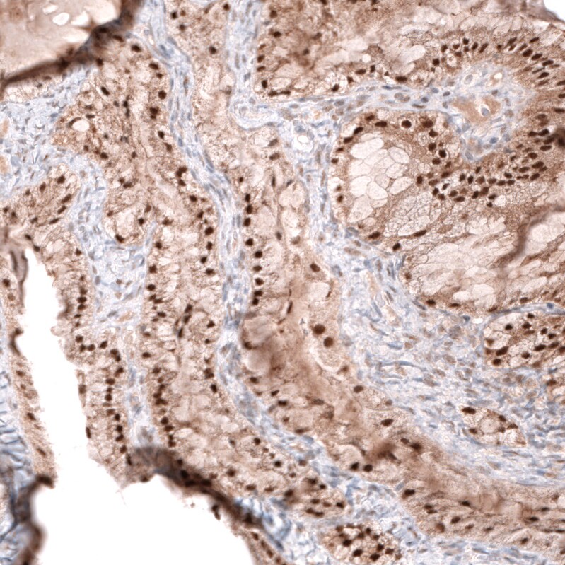 GREB1 Antibody (CL13859) - Azide and BSA Free Immunohistochemistry-Paraffin: GREB1 Antibody [NBP3-43839]