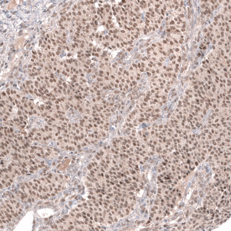 GREB1 Antibody (CL13859) - Azide and BSA Free Immunohistochemistry-Paraffin: GREB1 Antibody [NBP3-43839]