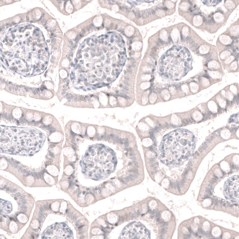 GREB1 Antibody (CL13859) - Azide and BSA Free Immunohistochemistry-Paraffin: GREB1 Antibody [NBP3-43839]