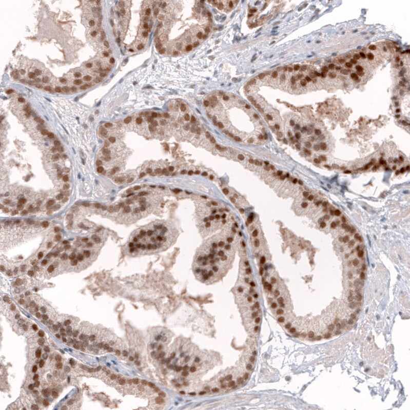 GREB1 Antibody (CL13859) - Azide and BSA Free Immunohistochemistry-Paraffin: GREB1 Antibody [NBP3-43839]