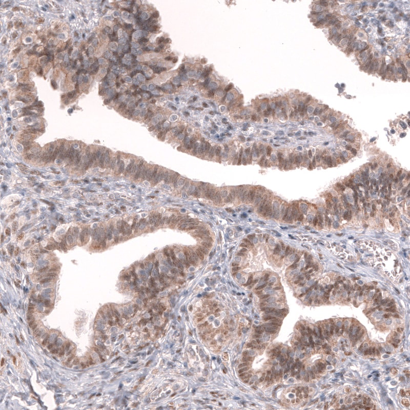 GREB1 Antibody (CL13863) - Azide and BSA Free Immunohistochemistry-Paraffin: GREB1 Antibody [NBP3-43840]