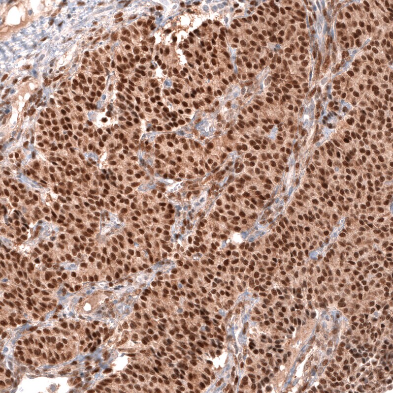 GREB1 Antibody (CL13863) - Azide and BSA Free Immunohistochemistry-Paraffin: GREB1 Antibody [NBP3-43840]
