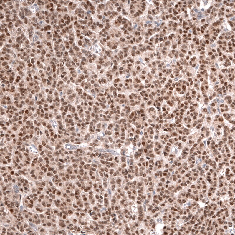 GREB1 Antibody (CL13863) - Azide and BSA Free Immunohistochemistry-Paraffin: GREB1 Antibody [NBP3-43840]