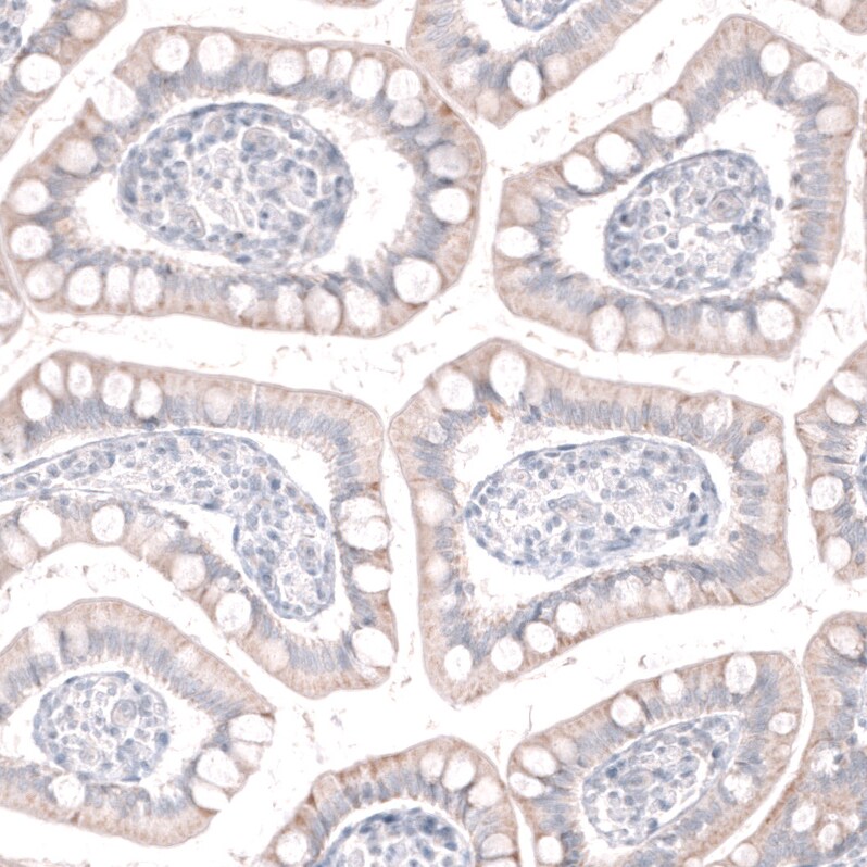 GREB1 Antibody (CL13863) - Azide and BSA Free Immunohistochemistry-Paraffin: GREB1 Antibody [NBP3-43840]