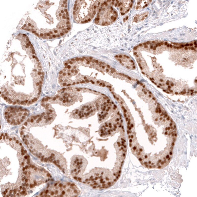 GREB1 Antibody (CL13863) - Azide and BSA Free Immunohistochemistry-Paraffin: GREB1 Antibody [NBP3-43840]