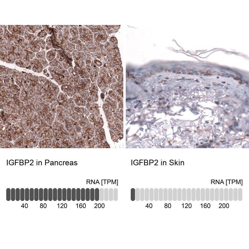 IGFBP-2 Antibody (CL13563) - Azide and BSA Free Immunohistochemistry-Paraffin: IGFBP-2 Antibody [NBP3-43841]