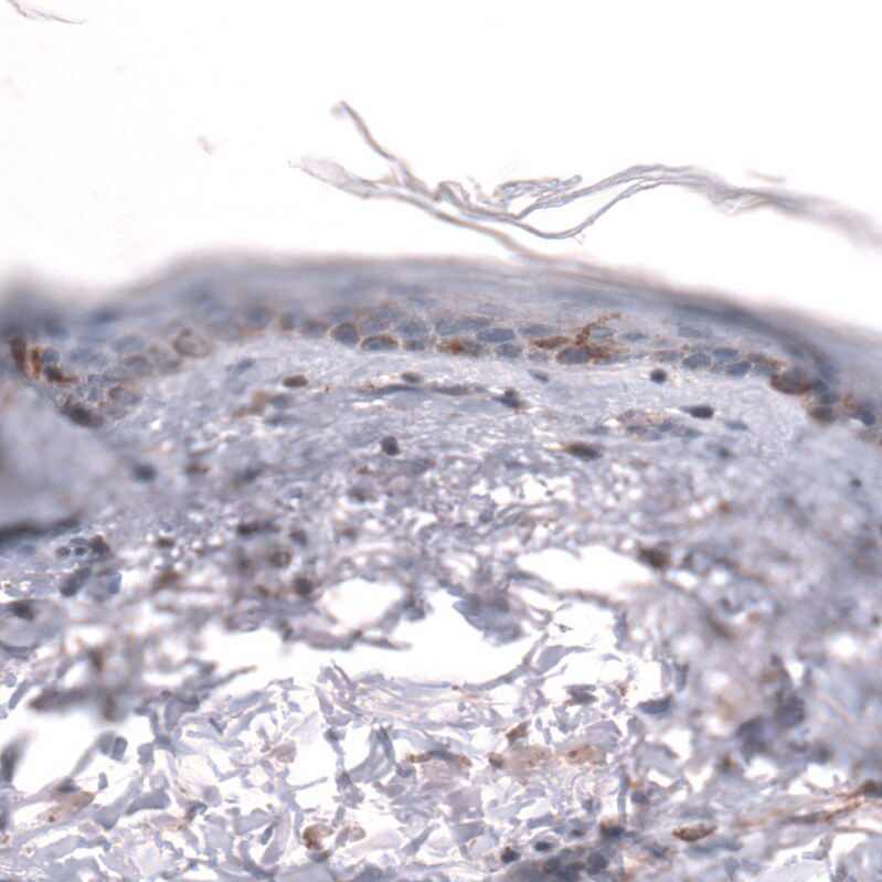 IGFBP-2 Antibody (CL13563) - Azide and BSA Free Immunohistochemistry-Paraffin: IGFBP-2 Antibody [NBP3-43841]