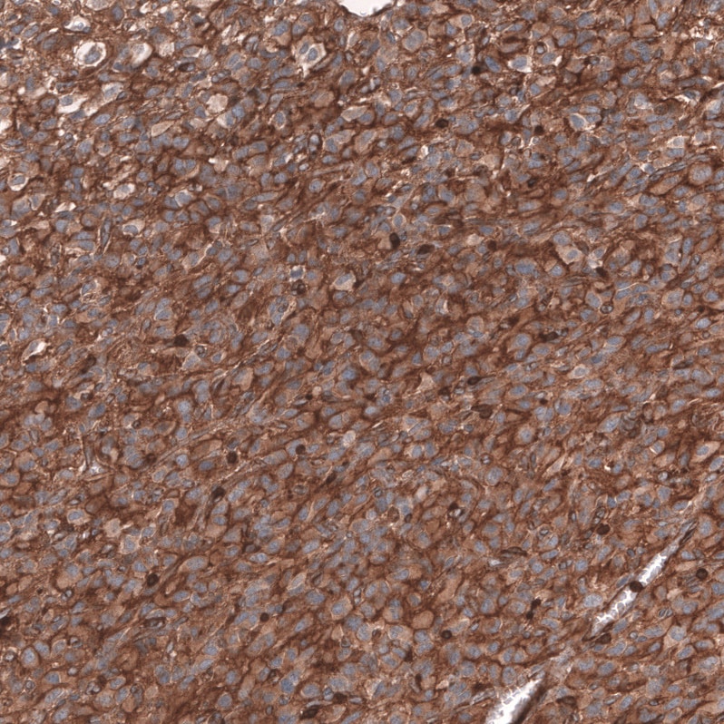 IGFBP-2 Antibody (CL13563) - Azide and BSA Free Immunohistochemistry-Paraffin: IGFBP-2 Antibody [NBP3-43841]