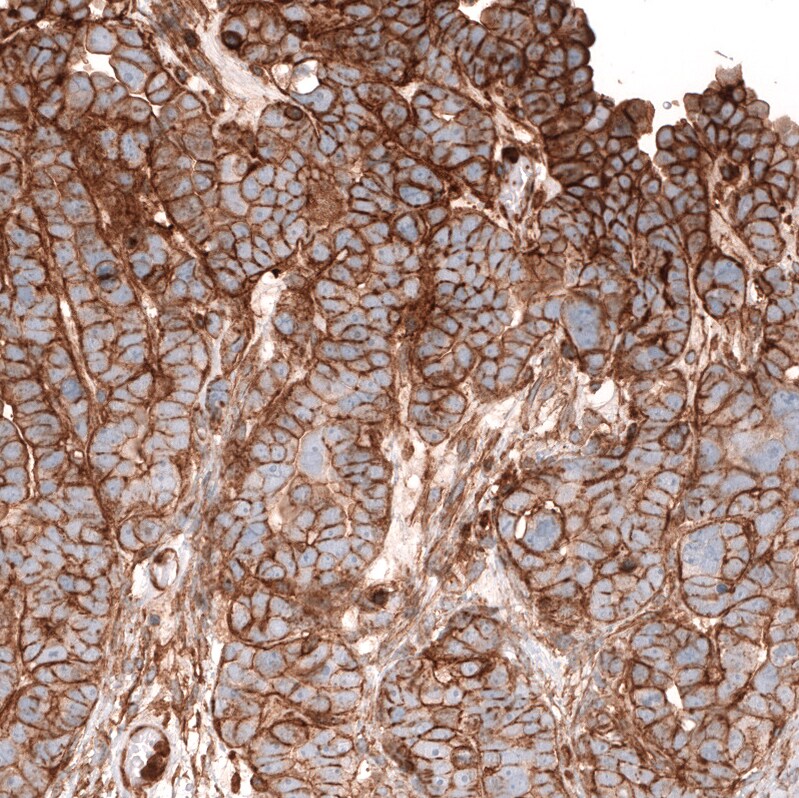 IGFBP-2 Antibody (CL13563) - Azide and BSA Free Immunohistochemistry-Paraffin: IGFBP-2 Antibody [NBP3-43841]