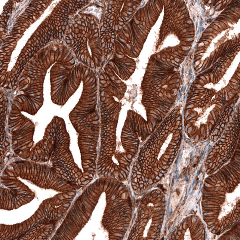 IGFBP-2 Antibody (CL13563) - Azide and BSA Free Immunohistochemistry-Paraffin: IGFBP-2 Antibody [NBP3-43841]