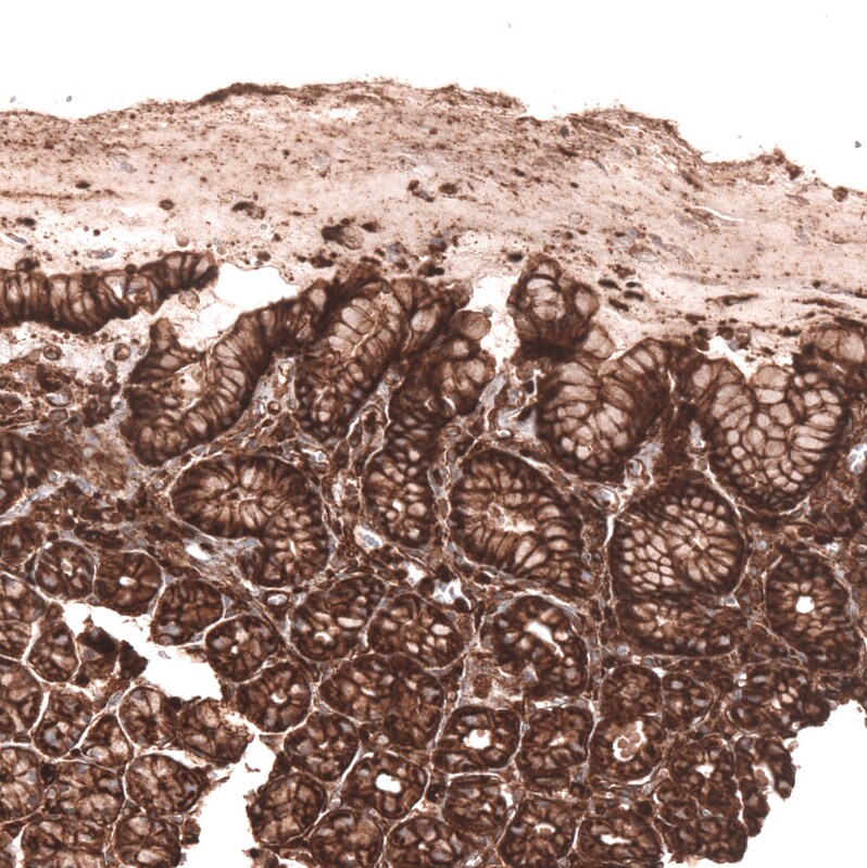 IGFBP-2 Antibody (CL13563) - Azide and BSA Free Immunohistochemistry-Paraffin: IGFBP-2 Antibody [NBP3-43841]