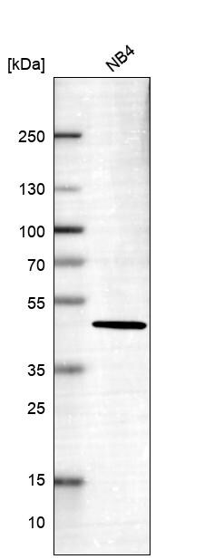 IGFBP-2 Antibody (CL13563) - Azide and BSA Free Western Blot: IGFBP-2 Antibody [NBP3-43841]