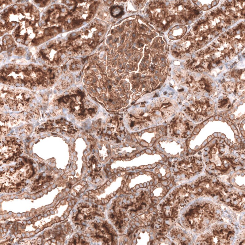 IGFBP-2 Antibody (CL13565) - Azide and BSA Free Immunohistochemistry-Paraffin: IGFBP-2 Antibody [NBP3-43842]