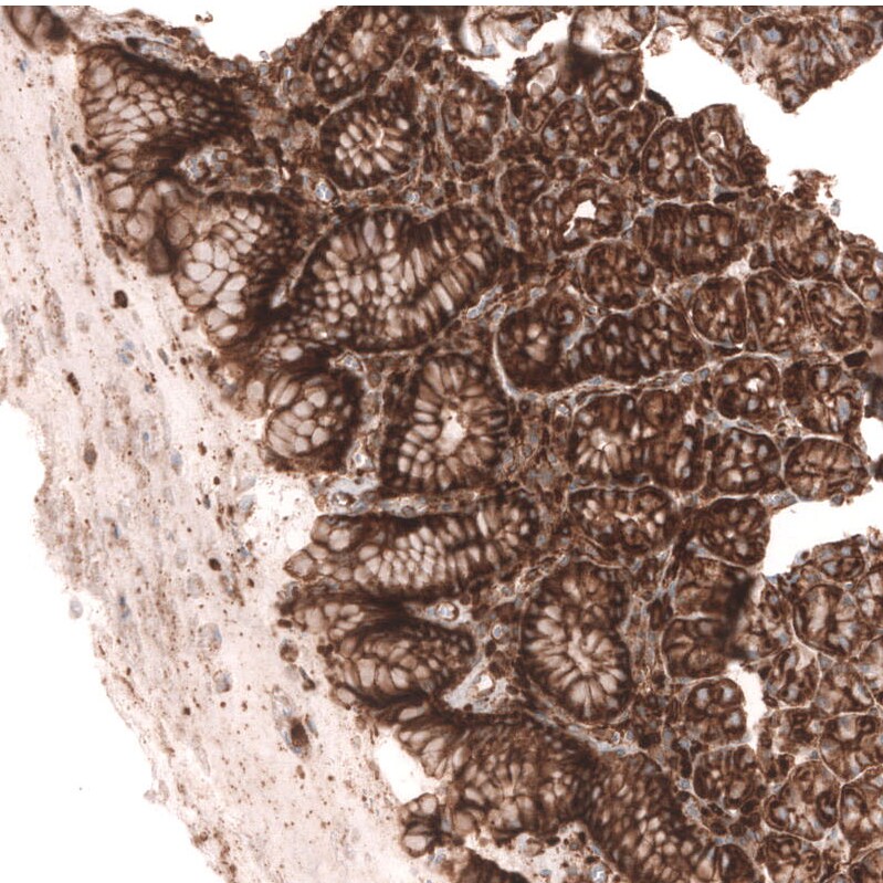 IGFBP-2 Antibody (CL13565) - Azide and BSA Free Immunohistochemistry-Paraffin: IGFBP-2 Antibody [NBP3-43842]