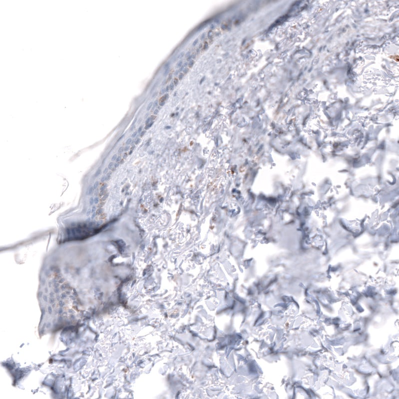 IGFBP-2 Antibody (CL13565) - Azide and BSA Free Immunohistochemistry-Paraffin: IGFBP-2 Antibody [NBP3-43842]