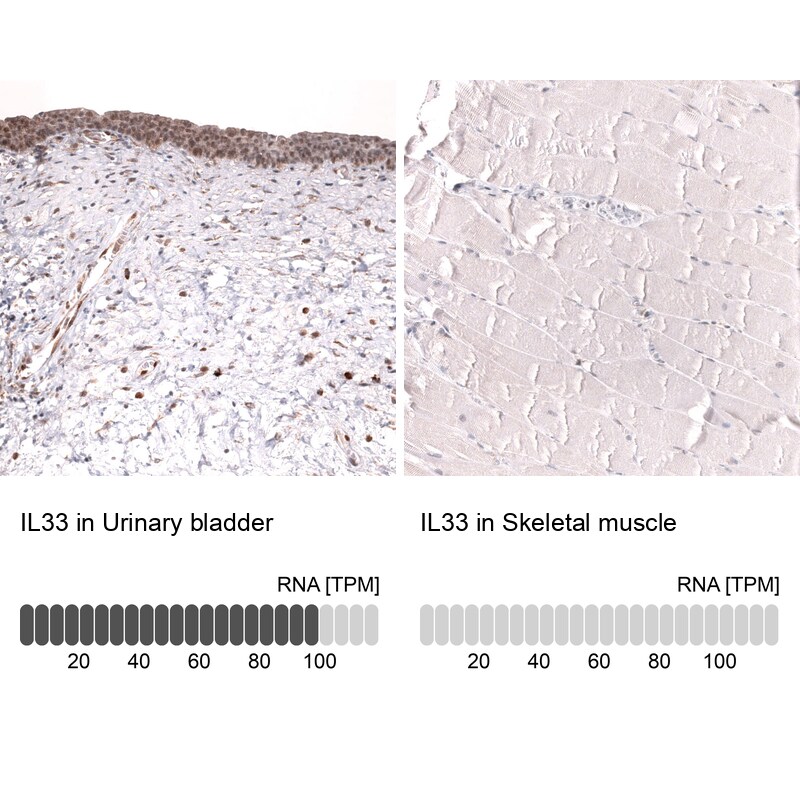 IL-33 Antibody (CL13438) - Azide and BSA Free Immunohistochemistry-Paraffin: IL-33 Antibody [NBP3-43843]