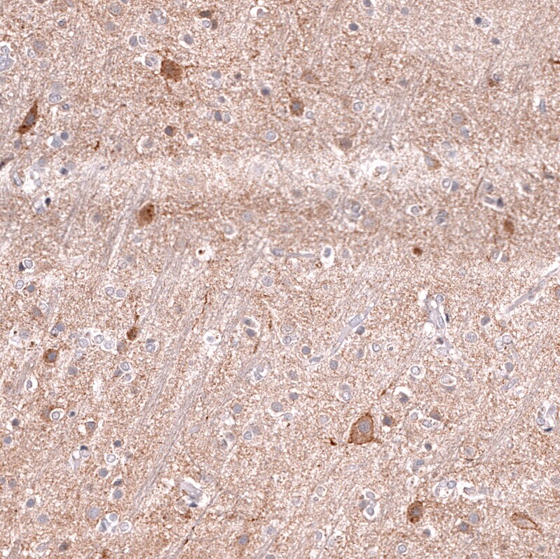 Lgr5/GPR49 Antibody (CL13567) - Azide and BSA Free Immunohistochemistry-Paraffin: Lgr5/GPR49 Antibody [NBP3-43844]