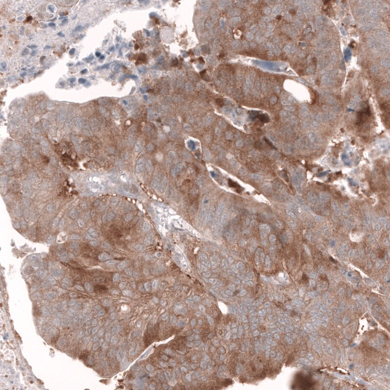 Lgr5/GPR49 Antibody (CL13567) - Azide and BSA Free Immunohistochemistry-Paraffin: Lgr5/GPR49 Antibody [NBP3-43844]