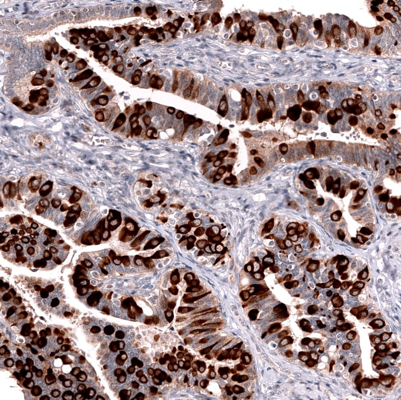 Lgr5/GPR49 Antibody (CL13567) - Azide and BSA Free Immunohistochemistry-Paraffin: Lgr5/GPR49 Antibody [NBP3-43844]