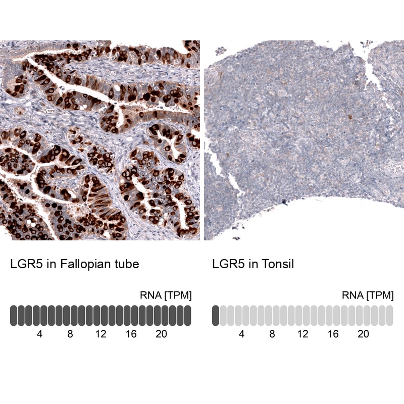 Lgr5/GPR49 Antibody (CL13567) - Azide and BSA Free Immunohistochemistry-Paraffin: Lgr5/GPR49 Antibody [NBP3-43844]