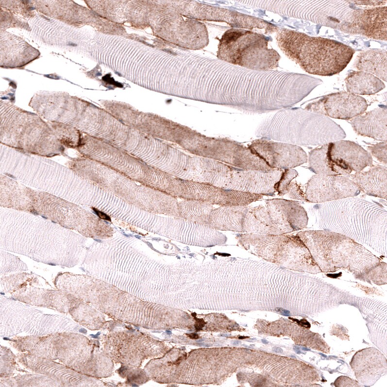 Lgr5/GPR49 Antibody (CL13567) - Azide and BSA Free Immunohistochemistry-Paraffin: Lgr5/GPR49 Antibody [NBP3-43844]